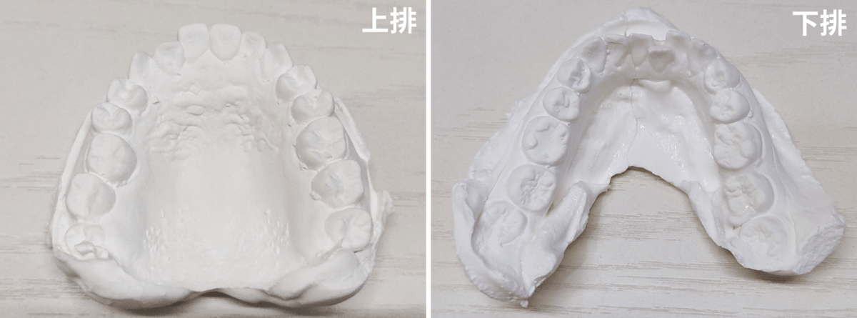 【牙套日記】諮詢篇:我的矯正費用大公開!專業度滿分的艾康牙醫陳彥朋醫師 - 第3張圖 【牙套日記】諮詢篇:我的矯正費用大公開!專業度滿分的艾康牙醫陳彥朋醫師